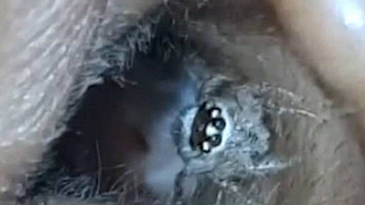 Ha Un Prurito All Orecchio Sconcertante Quel Che Scopre Video Ha Un Prurito All Orecchio Sconcertante Quel Che Scopre Video