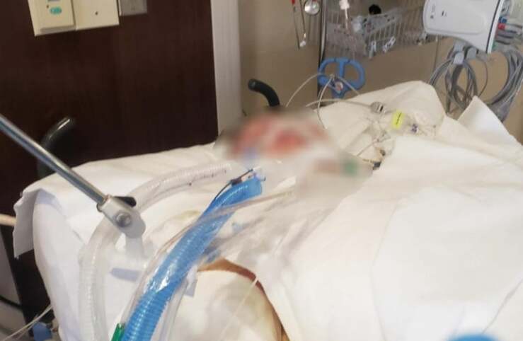 Donna finisce in ospedale dopo il gesto eroica (Foto Instagram)