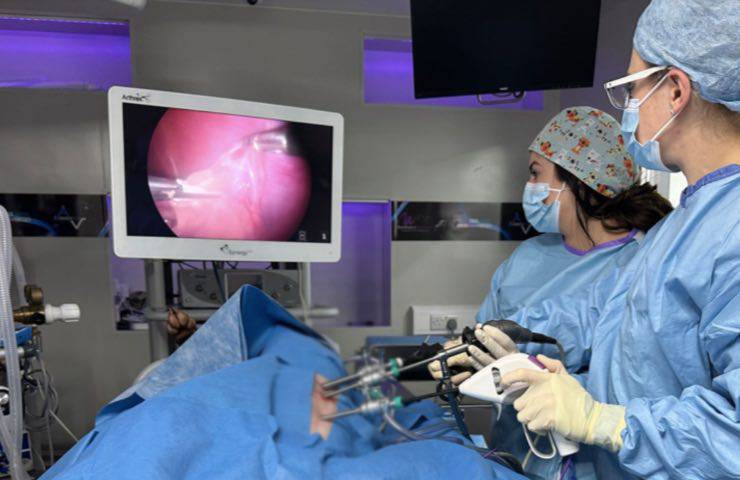 embolia causa infarto spinale