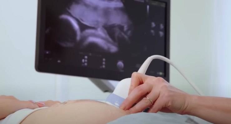 storia cane bambino camminare