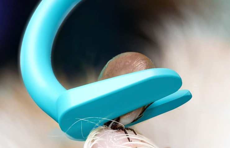 Pinza blu che toglie una zecca dalla pelle di un uomo