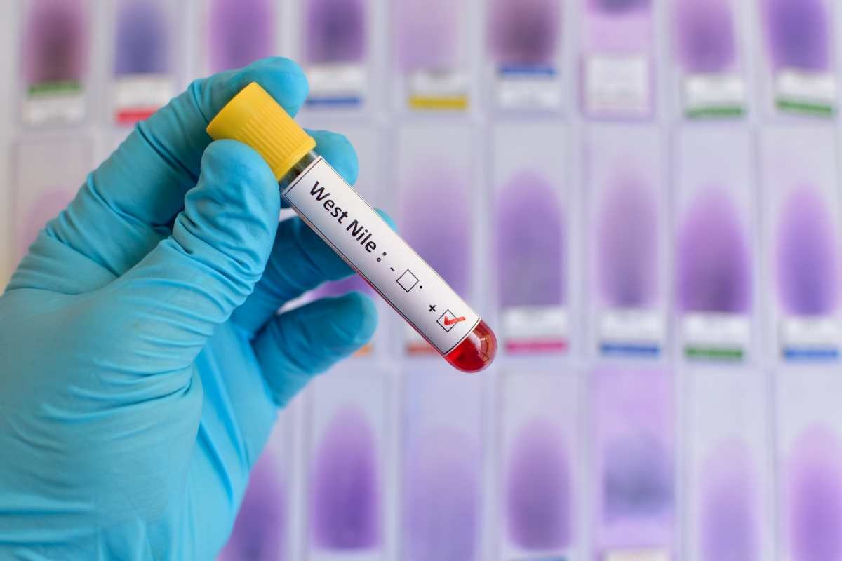 Campione di sangue con scritto West Nile